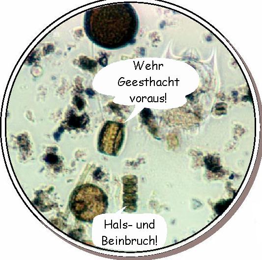 Mikroskopbild Algen, kommentiert von "Rettet die Elbe"